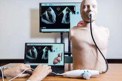Spółka chce wykorzystywać symulator nie tylkodo naukiwykonywaniajednego zabiegu,ale również do procedur,przy którychechokardiografiaprzezprzełykowa jest elementem całej operacji.