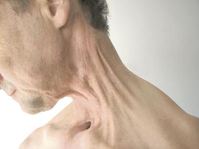 U pacjentów onkologicznych techniki rozluźniania mięśniowo-powięziowego należy stosować w miejscach, gdzie obserwuje się ograniczenia ruchomości tkanek. Terapia powinna rozpocząć się wkrótce po zagojeniu się rany.