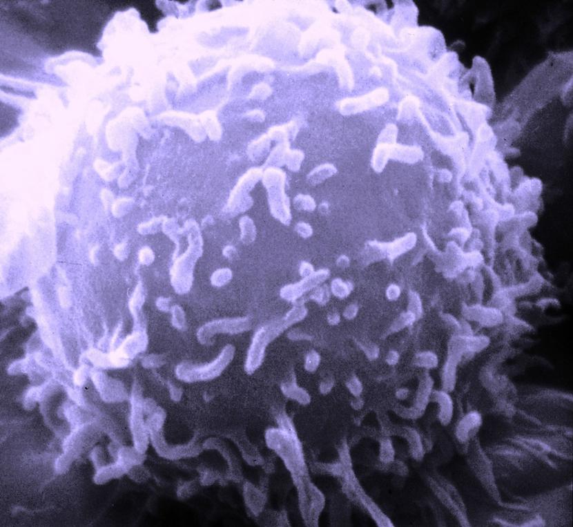 Komórka limfocytu, Fot. Dr. Triche National Cancer Institute, Wikipedia Commons Komórka limfocytu, Fot. Dr. Triche National Cancer Institute, Wikipedia Commons