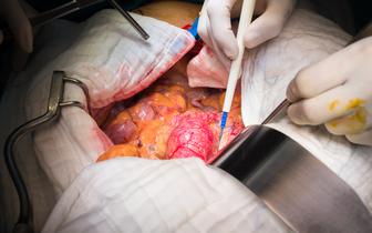 Kardiolodzy: wycena zabiegów kardiologii interwencyjnej zagraża bezpieczeństwu pacjentów