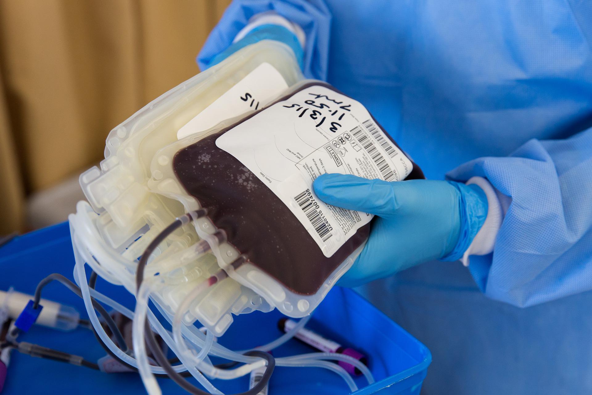 Projekt Nowej Ustawy O Krwiodawstwie I Krwiolecznictwie Lista Zmian Puls Medycyny 4883