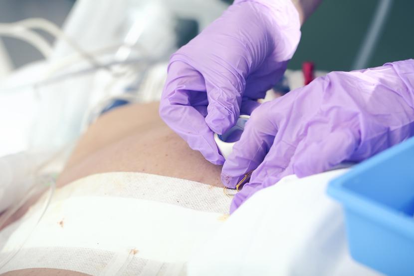 Na tempo gojenia się ran wpływa wiele czynników, m.in. wiek, płeć, obszar ciała oraz rozmiar rany. Na tempo gojenia się ran wpływa wiele czynników, m.in. wiek, płeć, obszar ciała oraz rozmiar rany.