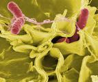 Rak okrężnicy: salmonella zwiększa ryzyko rozwoju nowotworu
