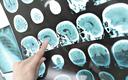 W centrum naukowym Braincity zbadają neuroplastyczność mózgu