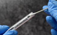 Test genetyczny wykrywający koronawirusa będzie można wykonać w aptece?