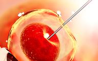 Pierwsza klinika in vitro not-for-profit w Anglii: co o tym sądzą eksperci? [SONDA]