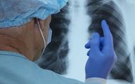 Gruźlica wciąż jest groźną chorobą zakaźną, która atakuje nie tylko płuca
