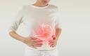 Helicobacter pylori główną przyczyną raka żołądka. Nowotwór może rozwijać się nawet przez kilkadziesiąt lat