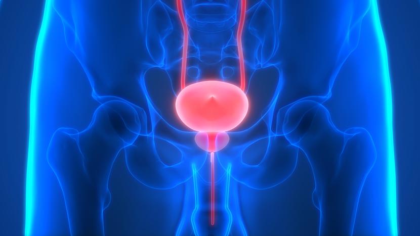 W Klinicznym Szpitalu Wojewódzkim nr 1 w Rzeszowie przeprowadzono zabiegi enukleacji laserowej gruczolaka stercza W Klinicznym Szpitalu Wojewódzkim nr 1 w Rzeszowie przeprowadzono zabiegi enukleacji laserowej gruczolaka stercza