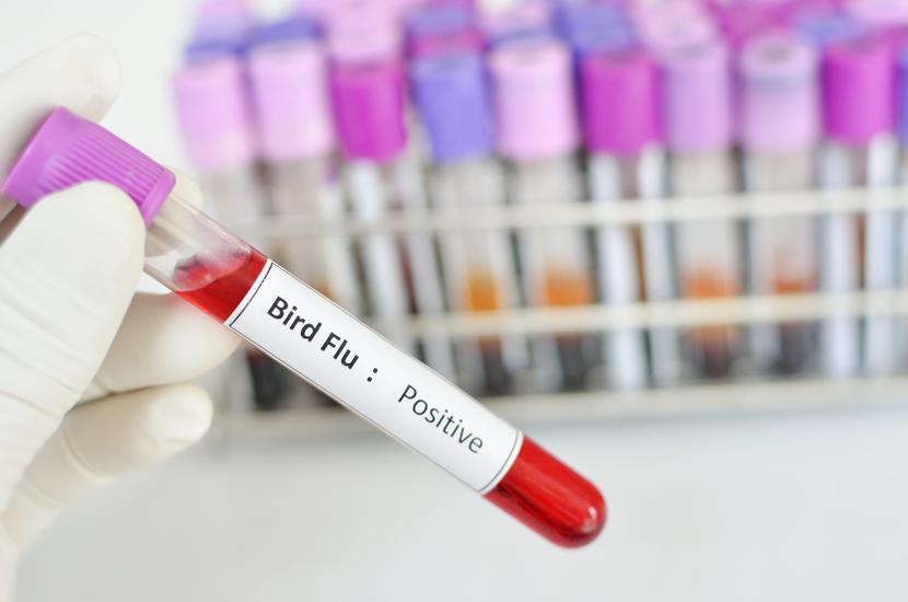 Specjaliści zaniepokojenie wysoką śmiertelnością osób zakażonych wirusem H5N1. Specjaliści zaniepokojenie wysoką śmiertelnością osób zakażonych wirusem H5N1.