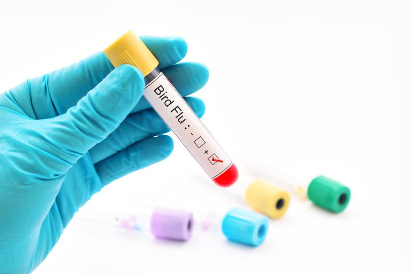 „To pierwszy potwierdzony laboratoryjnie przypadek zakażenia człowieka wirusem grypy A(H5N2) na świecie i pierwsza infekcja wirusem typu H5 u człowieka zgłoszona w Meksyku“ - podkreślało WHO w komunikacie. „To pierwszy potwierdzony laboratoryjnie przypadek zakażenia człowieka wirusem grypy A(H5N2) na świecie i pierwsza infekcja wirusem typu H5 u człowieka zgłoszona w Meksyku“ - podkreślało WHO w komunikacie.