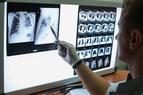 Będą nowe regulacje w zakresie ochrony radiologicznej, także w medycynie