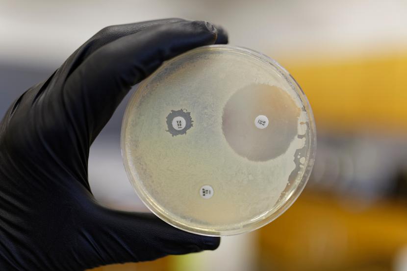 Płytka laboratoryjna pokazująca oporność bakterii na antybiotyki.