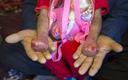 RPD apeluje do MZ ws. dzieci z pęcherzowym oddzielaniem się naskórka