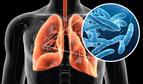 Nie żyje 22. osoba zakażona bakterią Legionella