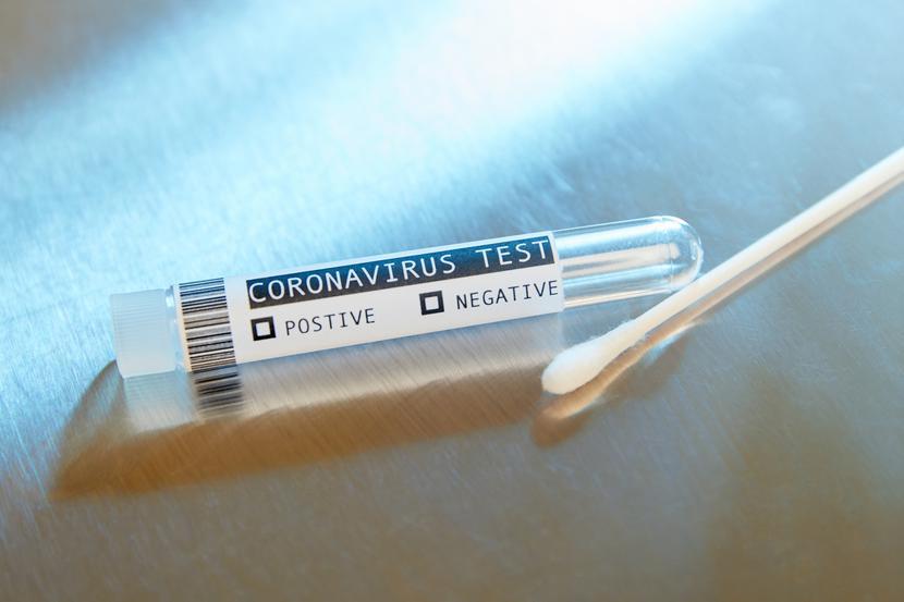 Jeśli idealnemu testowi przypisać wartość 1,0, to badanie krwi cechuje się precyzją na poziomie 0,97; śliny 0,8; a skóry - 0,88. Jeśli idealnemu testowi przypisać wartość 1,0, to badanie krwi cechuje się precyzją na poziomie 0,97; śliny 0,8; a skóry - 0,88.