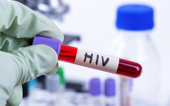 Rządowym programem leczenia HIV objętych jest blisko 20 tys. pacjentów