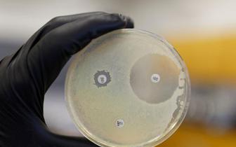 Sztuczna inteligencja pomogła odkryć antybiotyk przeciwko superbakterii