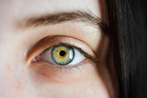 Najczęstszy nowotwór złośliwy oka: czerniak błony naczyniowej