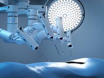 Chirurgia robotowa w Polsce cały czas w trendzie wzrostowym [RAPORT]