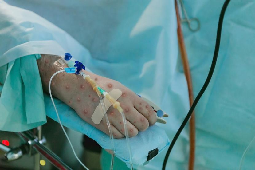 Obecnie ogniska występują w kilkunastu państwach Afryki, chorują zarówno dorośli, jak i dzieci, odnotowano ponad 500 zgonów. Obecnie ogniska występują w kilkunastu państwach Afryki, chorują zarówno dorośli, jak i dzieci, odnotowano ponad 500 zgonów.