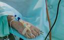 Czy grozi nam epidemia małpiej ospy? Epidemiolog: ryzyko jest nieduże