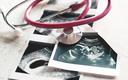 Ekspert o wytycznych dot. aborcji: zagrożenie życia kobiety nie musi być bezpośrednie