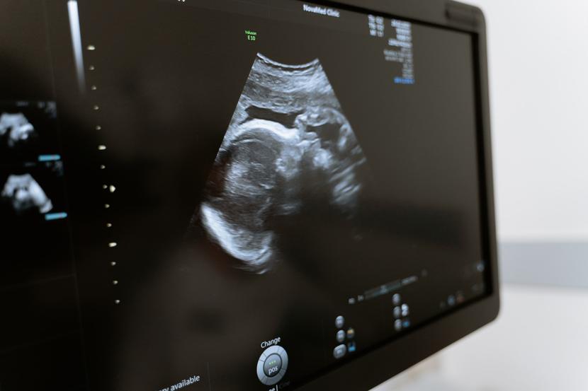 Kontrola przeprowadzona w szpitalu w Pszczynie przez NFZ potwierdziła liczne nieprawidłowości w organizacji, sposobie realizacji i w jakości świadczeń udzielonych pani Izabeli z Pszczyny. Kontrola przeprowadzona w szpitalu w Pszczynie przez NFZ potwierdziła liczne nieprawidłowości w organizacji, sposobie realizacji i w jakości świadczeń udzielonych pani Izabeli z Pszczyny.