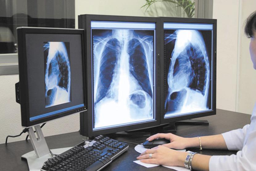 Cyfryzacja obrazów medycznych w połączeniu ze standaryzacją ich zapisu oraz możliwością transferu za pośrednictwem Internetu (z uwzględnieniem odpowiednich zabezpieczeń) okazały się spornym osiągnięciem, ale dość drogim i nierzadko skomplikowanym. 