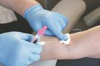 Nowotwory krwi - podstawowe znaczenie ma wczesna diagnostyka