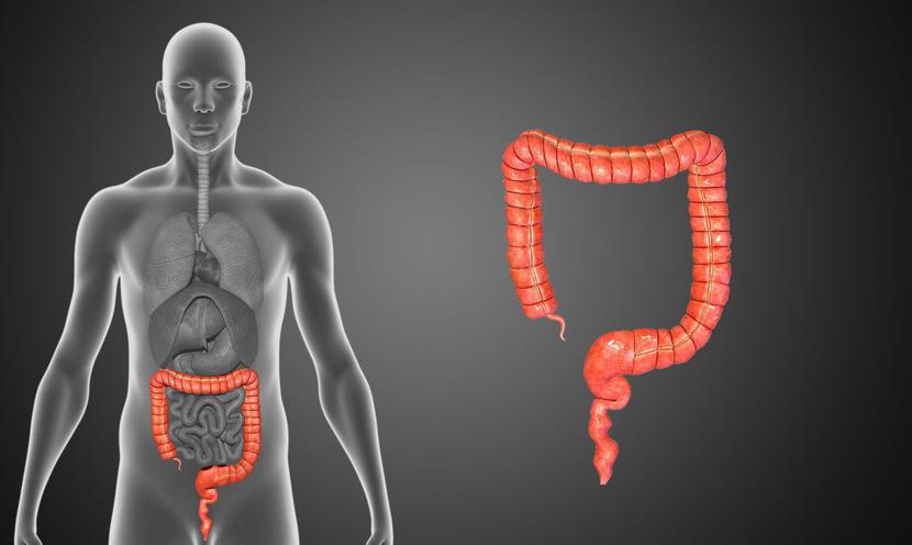 Rak Jelita Grubego Stosowanie Antybiotyków Zwiększa Ryzyko Jego Rozwoju Puls Medycyny 1017