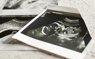 TK: prawdopodobieństwo ciężkich wad płodu niewystarczające dla dopuszczalności aborcji