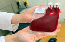 Rośnie zainteresowanie komórkami z krwi pępowinowej. Ekspert z USA tłumaczy, dlaczego