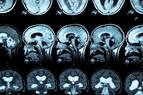 Emilka z Ukrainy miała wodogłowie, jej szpital zbombardowano. Zoperowali ją neurochirurdzy ze Szczecina