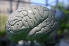 Migreny zmieniają strukturę mózgu