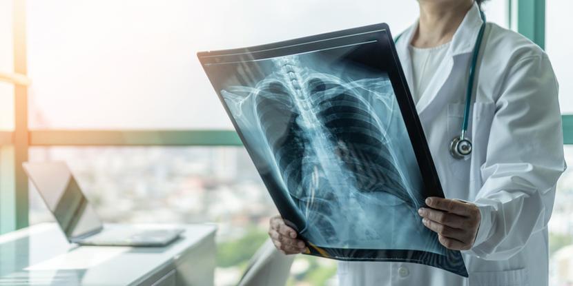 Do programu rehabilitacji po COVID-19 będzie można dołączyć do 12 miesięcy od zakończenia leczenia.