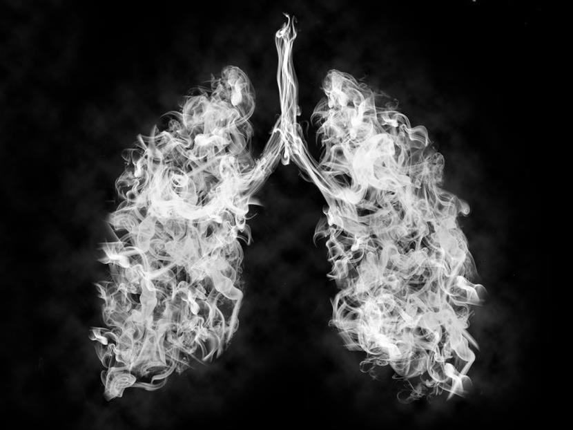 W 2019 r. MZ uruchomiło Ogólnopolski Program Wczesnego Wykrywania Raka Płuca (WWRP) za pomocą Niskodawkowej Tomografii Komputerowej (NDTK).