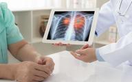 Będzie pilotaż elektronicznych spirometrów w POZ i AOS. Skorzystają dorośli ozdrowieńcy