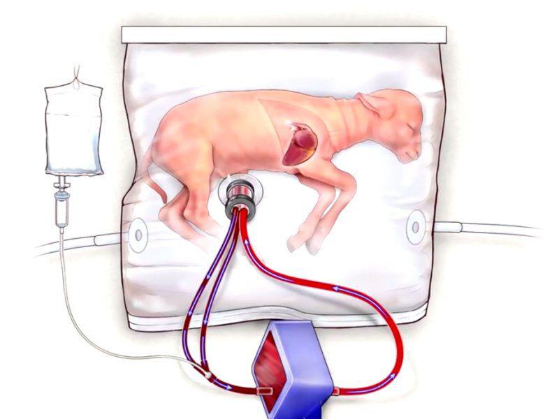 https://www.sciencedaily.com/releases/2017/04/170425110807.htm