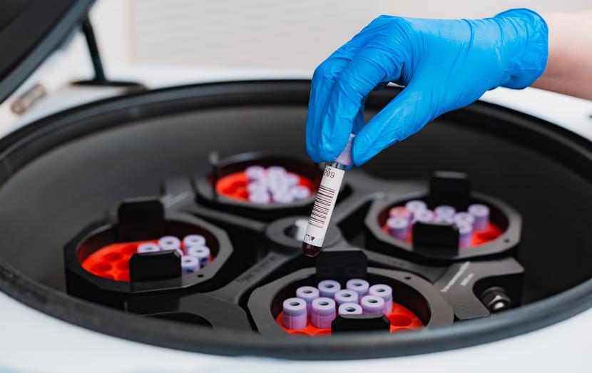 13 września projektem ustawy o diagnostyce laboratoryjnej zajęła się sejmowa Komisja Zdrowia. 13 września projektem ustawy o diagnostyce laboratoryjnej zajęła się sejmowa Komisja Zdrowia.