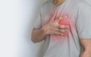 Objawy zawału serca mogą być nietypowe nawet u 14 proc. pacjentów