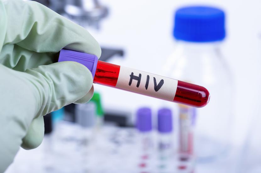 W ubiegłym roku ok. 630 tys. osób na świecie zmarło z powodu chorób związanych z AIDS. W ubiegłym roku ok. 630 tys. osób na świecie zmarło z powodu chorób związanych z AIDS.