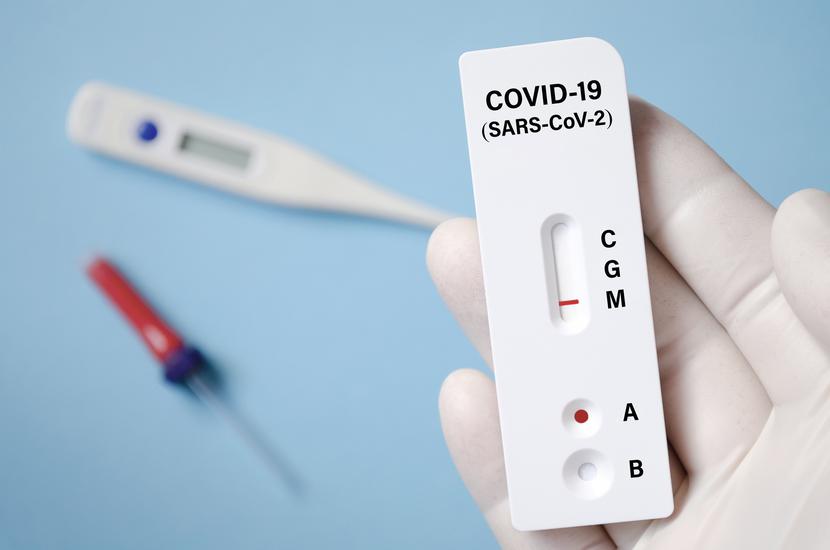 Apteki sprzedają zdecydowanie więcej testów wykrywających wirusa SARS-CoV-2 niż podaje Ministerstwo Zdrowia