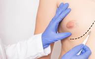 Rak piersi u mężczyzn: w wykryciu pomaga rutynowa mammografia