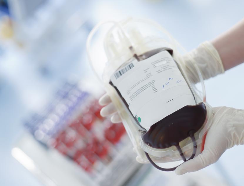 Na razie terapia dla chorych hematologicznie jest przedstawiana jako nadzieja na wyeliminowanie potrzeby transfuzji.