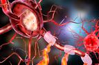 Co trzeciego z nas dotknie choroba neurologiczna. Prof. Rejdak o “ogromnej rewolucji” w leczeniu