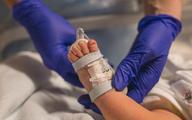 Neonatolog: umiera nawet 80 proc. noworodków o wadze 500-600 gramów