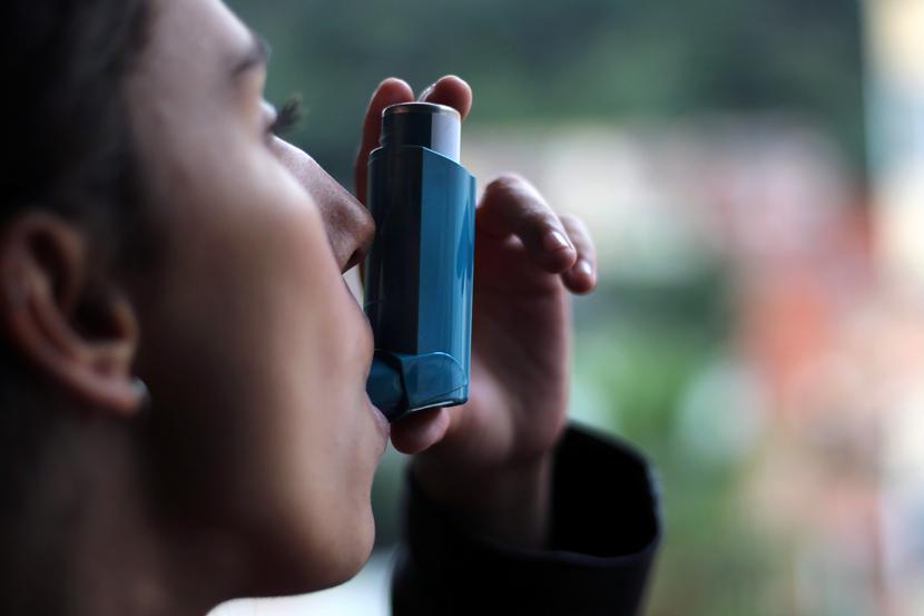 Astma alergiczna rozpoczyna się wcześnie, charakteryzuje ją m.in. współistnienie z atopią, dodatnie wyniki IgE, występowanie w rodzinie i dobra odpowiedź na leczenie wziewnymi glikokortykosteroidami. Astma alergiczna rozpoczyna się wcześnie, charakteryzuje ją m.in. współistnienie z atopią, dodatnie wyniki IgE, występowanie w rodzinie i dobra odpowiedź na leczenie wziewnymi glikokortykosteroidami.