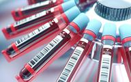 Badanie anty-HCV w katalogu badań polecanych przez lekarzy POZ