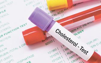 Nadciśnienie i wysoki cholesterol związane z wyższym ryzykiem alzheimera [BADANIA]